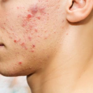 *Individual Results May Vary