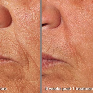 Fractiona-B&A-web Fractiona-B&A-web