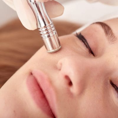 microdermabrasion-chicago best microdermabrasion specialist