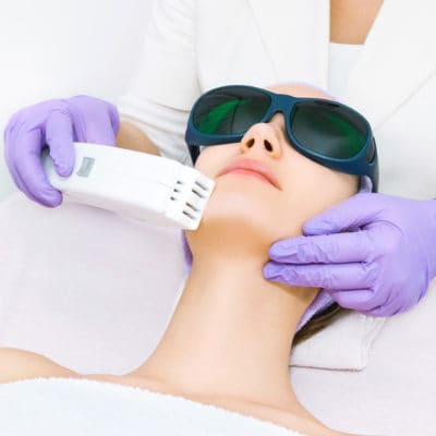 photofacial-chicago photofacial skin treatment