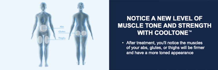 CoolTone-treatment-areas