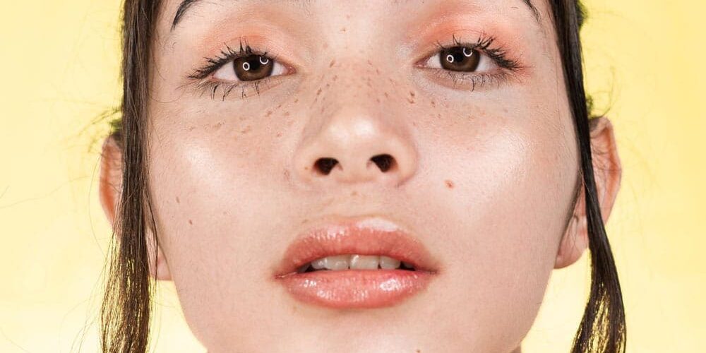 fillers cosmetic fillers