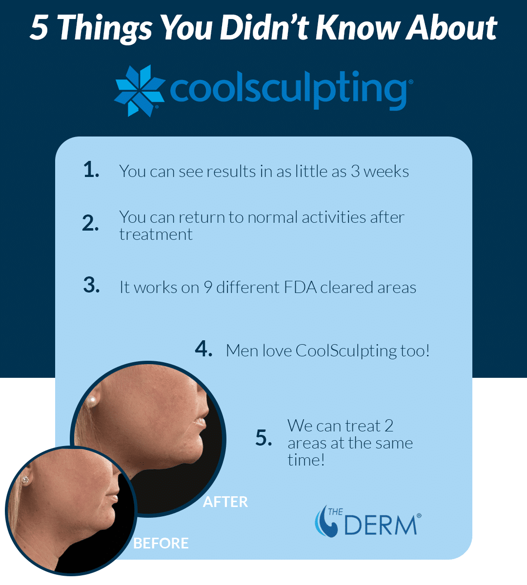 things you didn't know about coolsculpting things you didn't know about coolsculpting