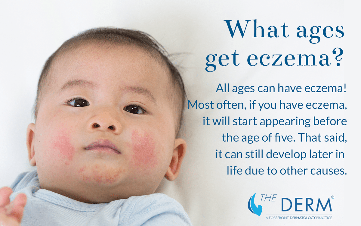 what ages get eczema what ages get eczema