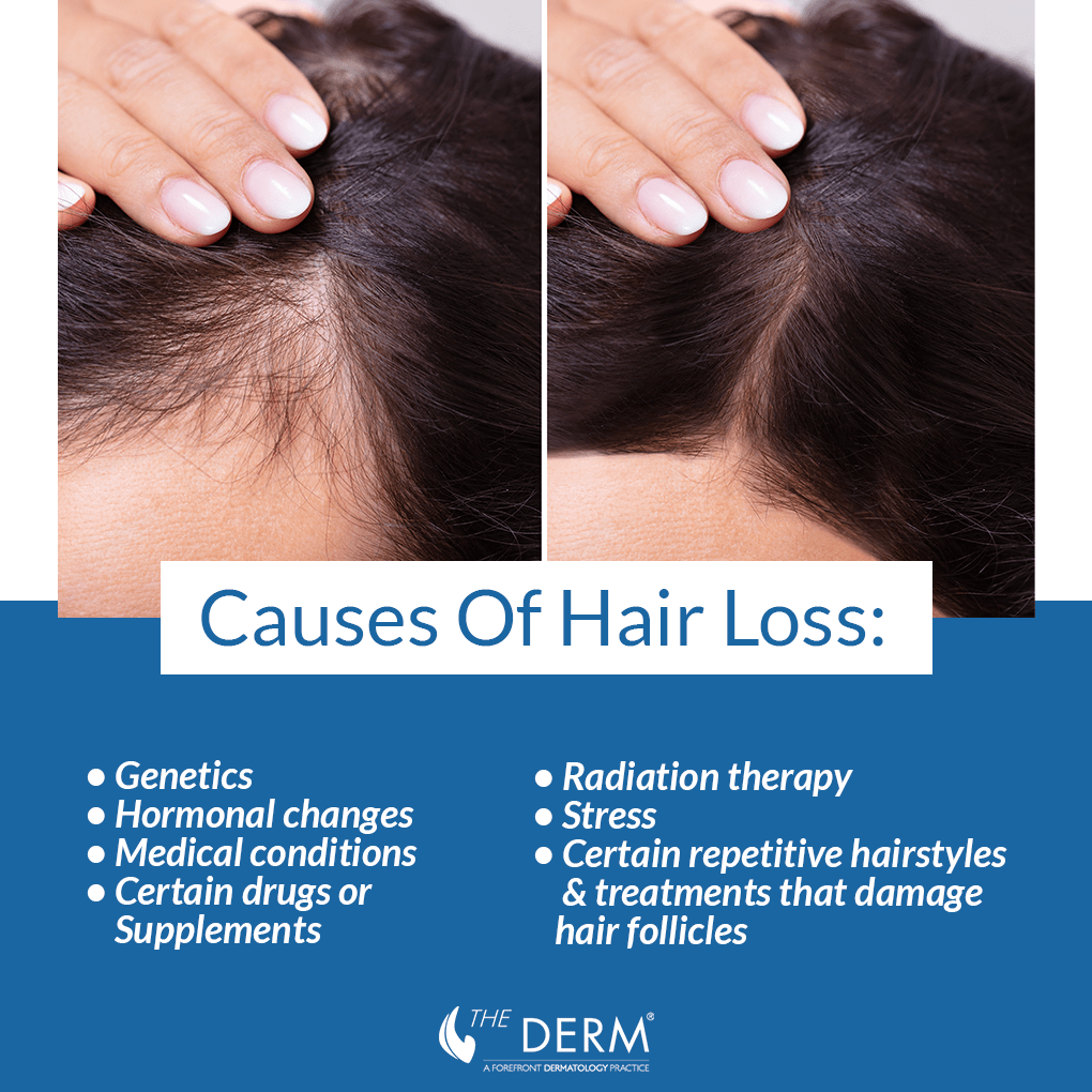 causes of hair loss