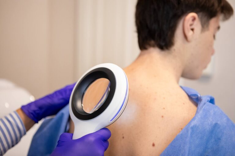 ffd_blog_skin-cancer-stats-you-cant-afford-to-ignore