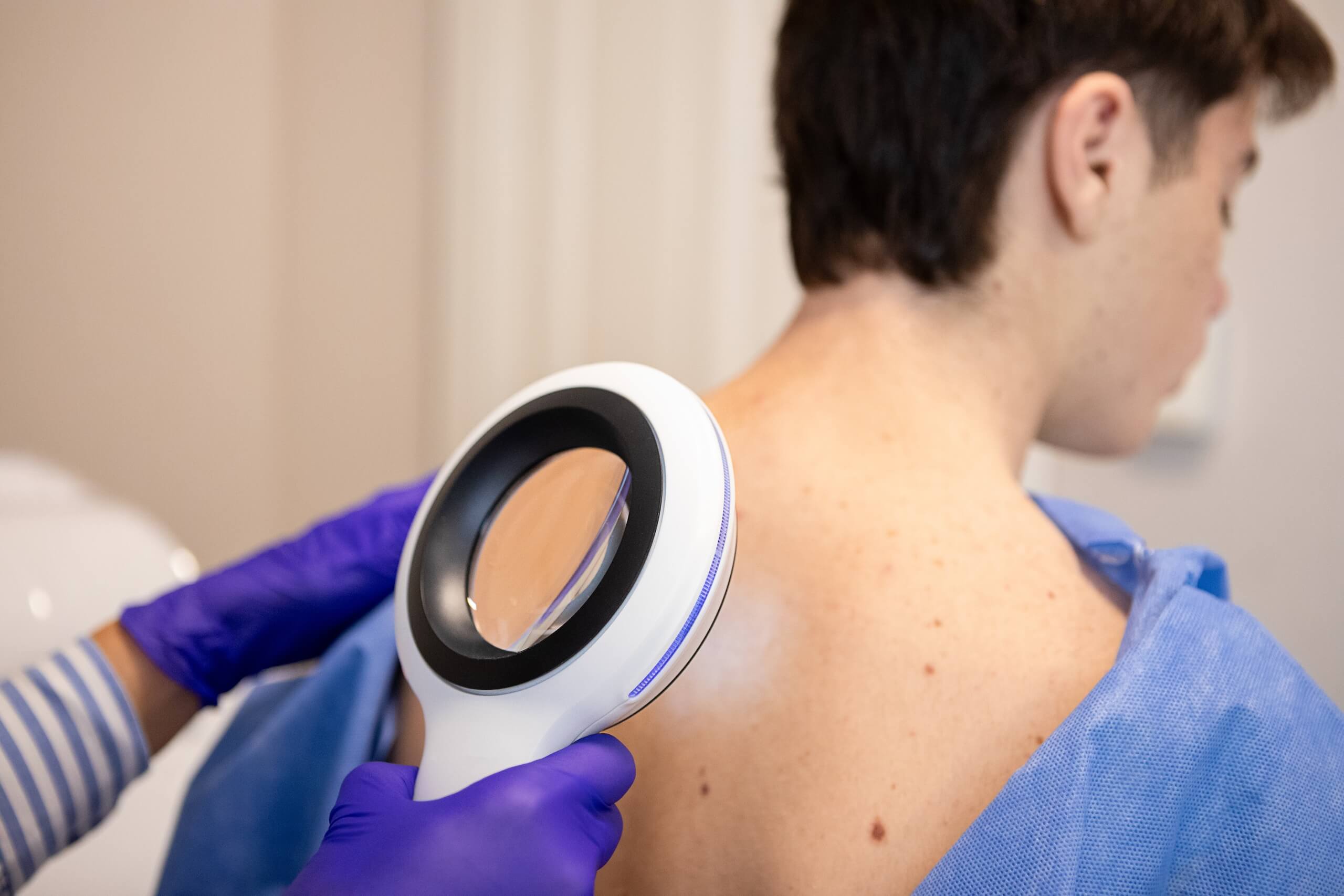ffd_blog_skin-cancer-stats-you-cant-afford-to-ignore
